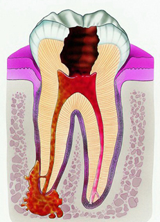 surg2