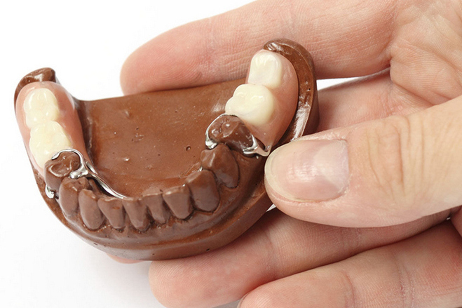 Clasp prosthetics