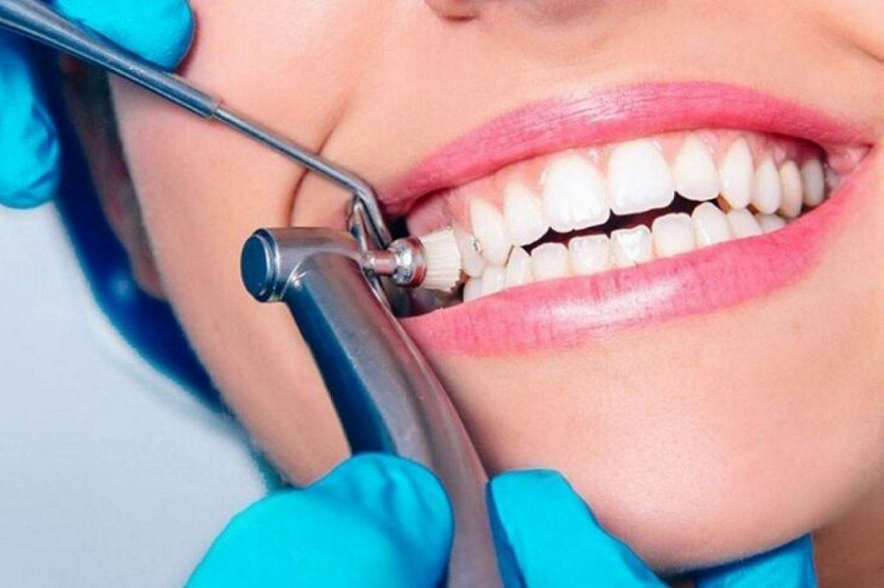 Professional teeth cleaning