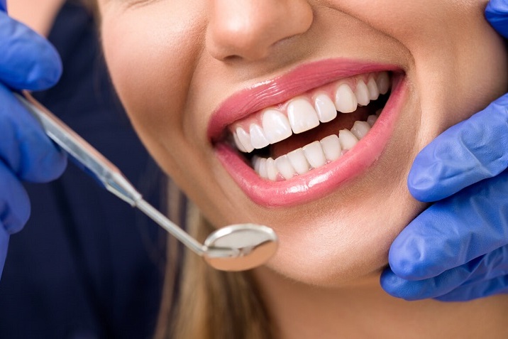 Treatment of caries and prevention: how to maintain healthy teeth