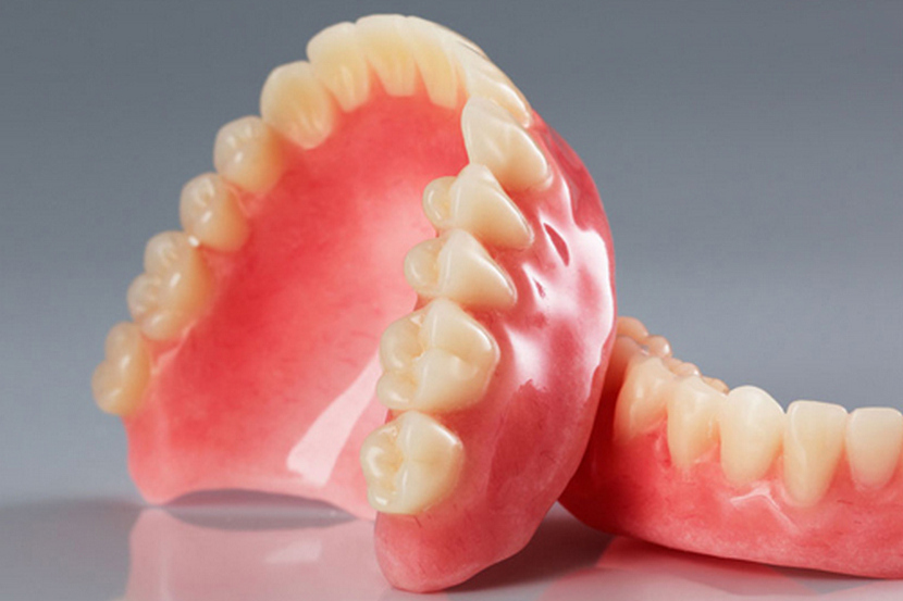 Why is it necessary to replace old fillings and what materials are best to choose instead?