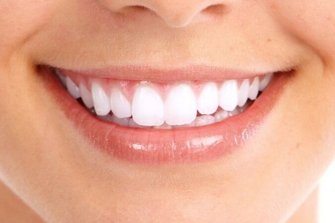 Dental bridge: what is it and when should it be installed?